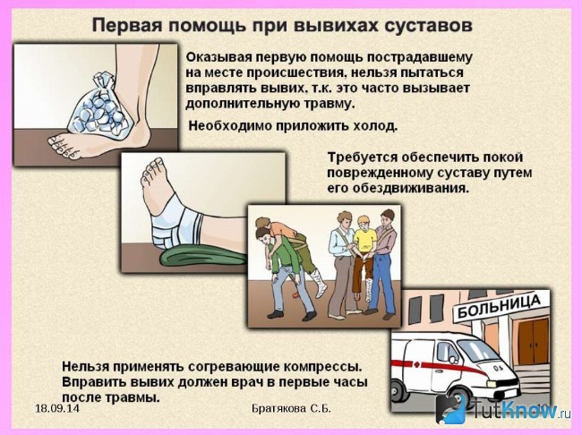 Первая помощь при вывихе ноги в домашних условиях Первая помощь при вывихе ноги в домашних условиях