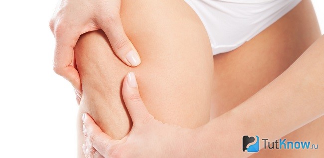 Фитнес body крем актив от целлюлита отзывы