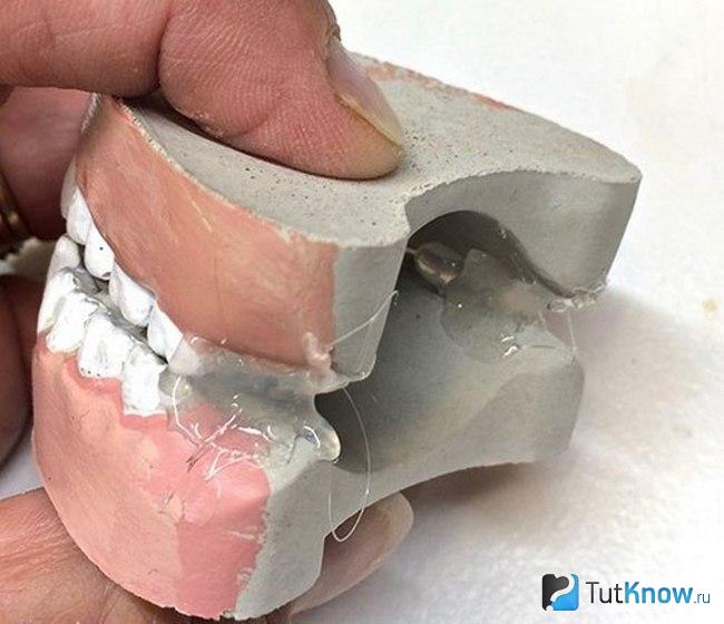 Цементная челюсть удерживается пальцами
