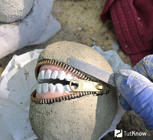 Область вокруг зубов покрывается цементом