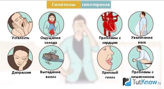 Схема симптомов гипотиреоза