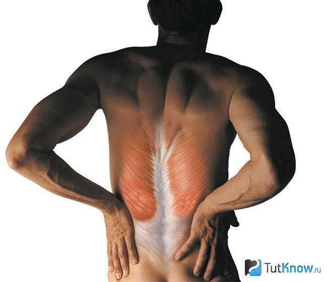 Схематическое изображение мышц поясничного отдела спины