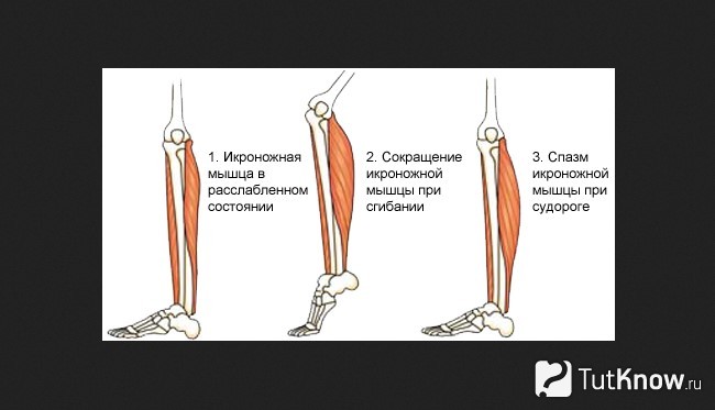 Икроножная мышца картинка