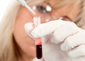 Пускание крови: показания, противопоказания и особенности