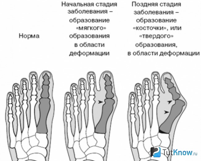 Названия стоп. Название пальцев на ноге. Название пальцев стопы. Пальцы на ногах название. Название пальцев на стопе ноги.