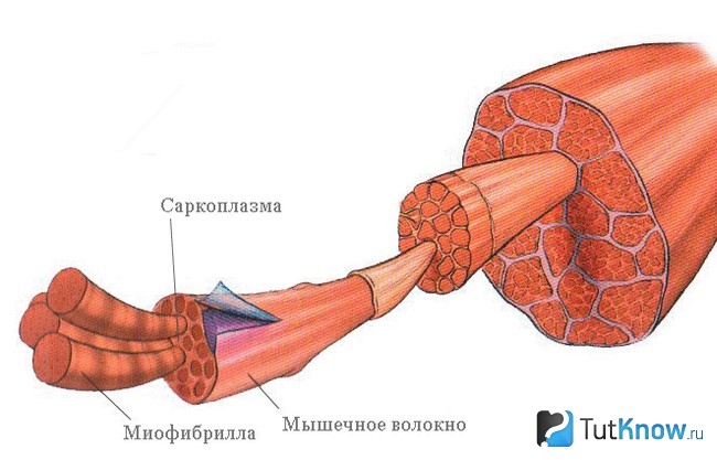 Гиперплазия мышц