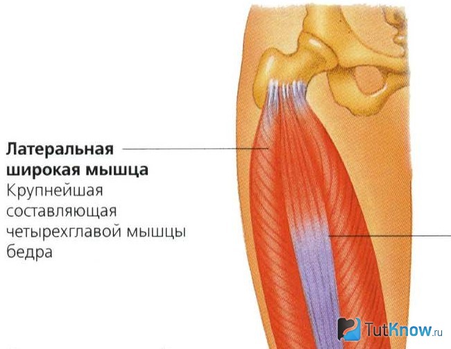 Латеральная широкая мышца бедра болит