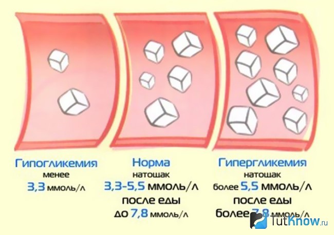 Схема норм употребления сахара