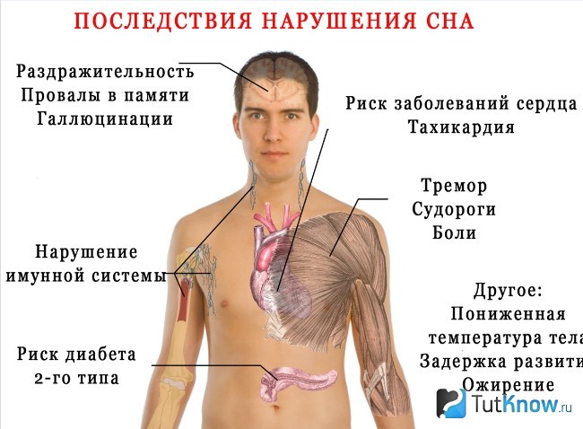 Последствия нарушения сна для человека
