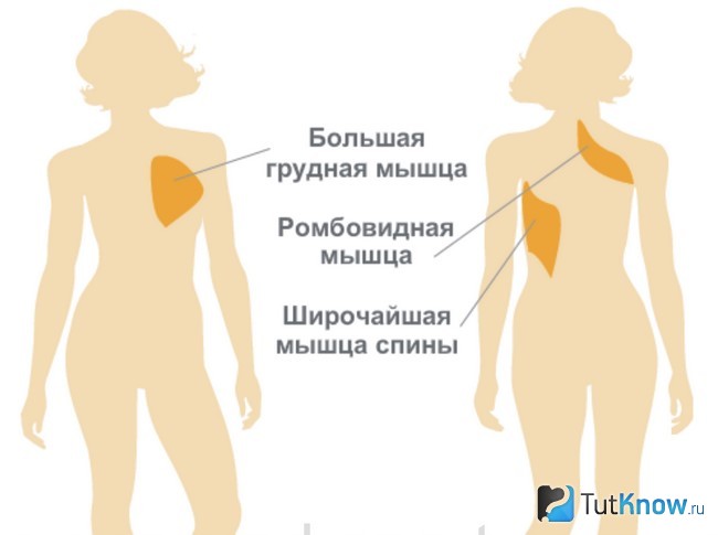 Схематическое изображение ромбовидных мускулов спины