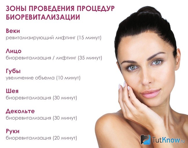 Зоны проведения биоревитализации