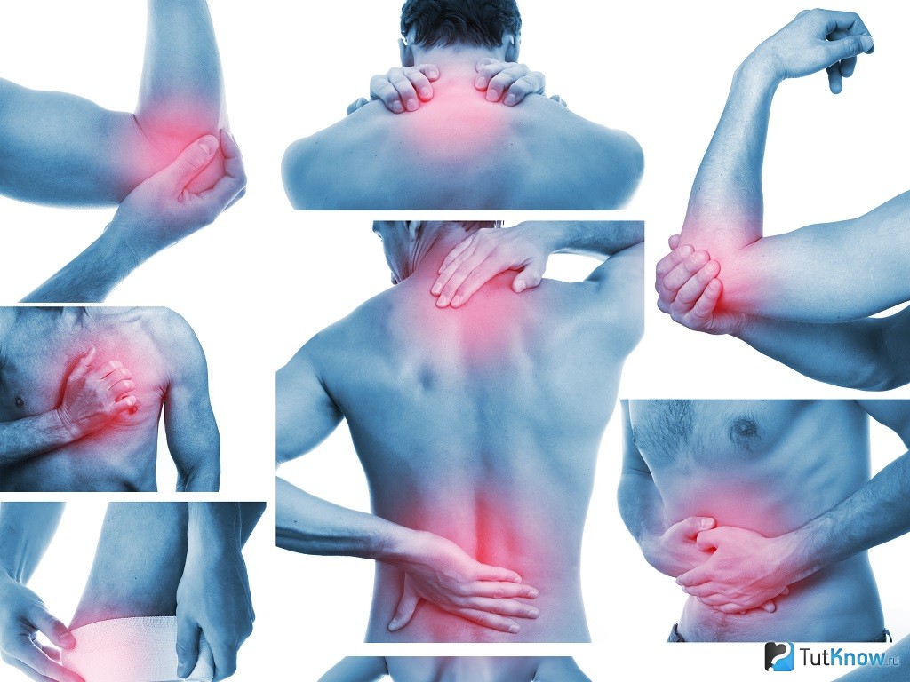 Боли в мышцах всего тела причины лечение. Мышечная боль.