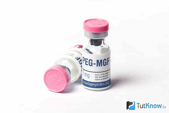 Peg MGF