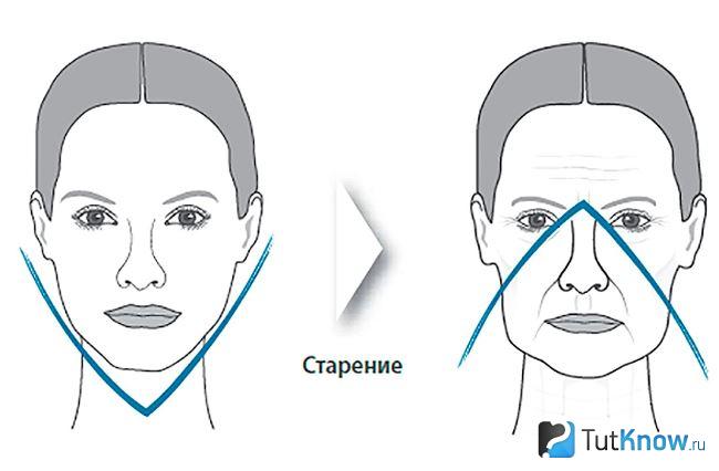 что такое бульдожки на лице разговорное. Смотреть фото что такое бульдожки на лице разговорное. Смотреть картинку что такое бульдожки на лице разговорное. Картинка про что такое бульдожки на лице разговорное. Фото что такое бульдожки на лице разговорное
