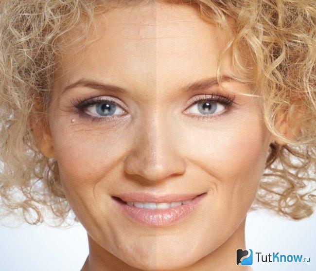 что такое бульдожки на лице разговорное. Смотреть фото что такое бульдожки на лице разговорное. Смотреть картинку что такое бульдожки на лице разговорное. Картинка про что такое бульдожки на лице разговорное. Фото что такое бульдожки на лице разговорное