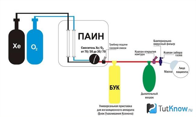 Схематическое изображение процесса ксеноновой ингаляции