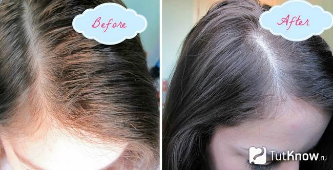 Волосы девушки до применения сухого шампуня и после
