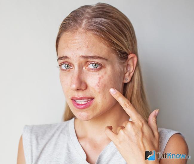 Аллергия на лице как противопоказание к применению овсяной муки