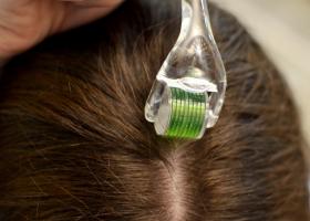 Как использовать мезороллер для волос?