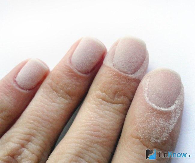 Акриловая пудра на ногтях