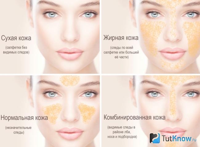 Основные типы кожи