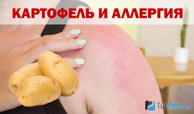 Аллергия на картофель