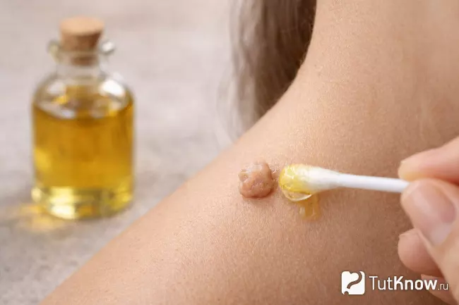 Касторовое масло и папилломы, домашнее нанесение