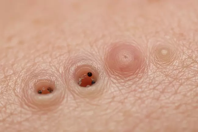 Причины воспалений лица и домашний уход