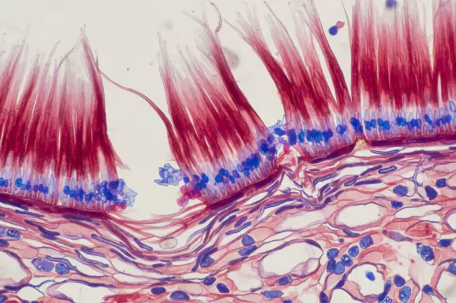 Восстановление мышц после нагрузки и микроповреждений