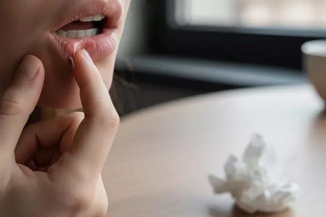 Ошибки ухода за губами: сухость и трещины